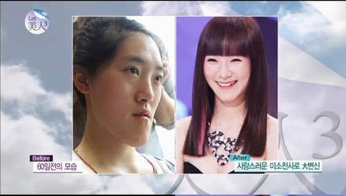 中國(guó)“恐龍女”上韓國(guó)整容節(jié)目變芭比娃娃