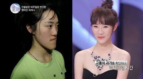 中國(guó)“恐龍女”上韓國(guó)整容節(jié)目變芭比娃娃