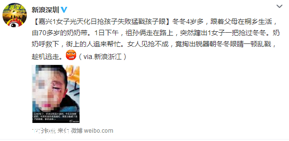 嘉興女子光天化日搶孩子 失敗后猛戳孩子眼睛