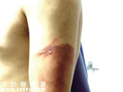 女店主潑面湯燙執(zhí)法人員 其夫大呼