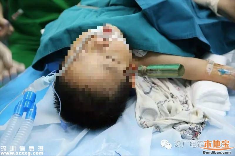 深圳男童被螺絲刀穿腦 14cm螺絲刀插入10cm