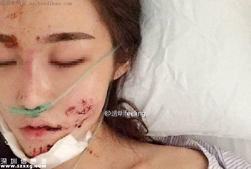 深圳女子乘豪車被毀容 肇事司機涉嫌頂包酒駕