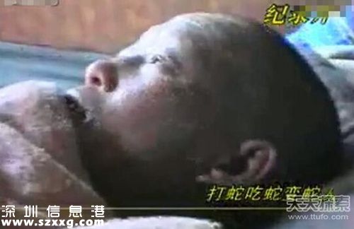 打蛇吃蛇無(wú)數(shù)竟變“蛇人” 