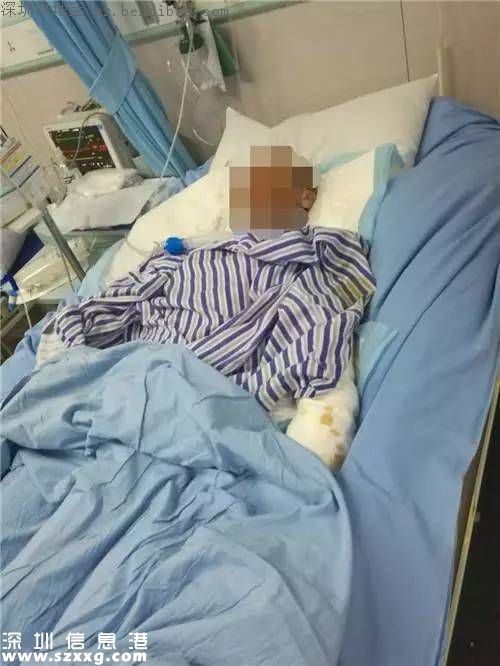 寶安發(fā)生煤氣爆燃事故 因為女子做了這么一個動作