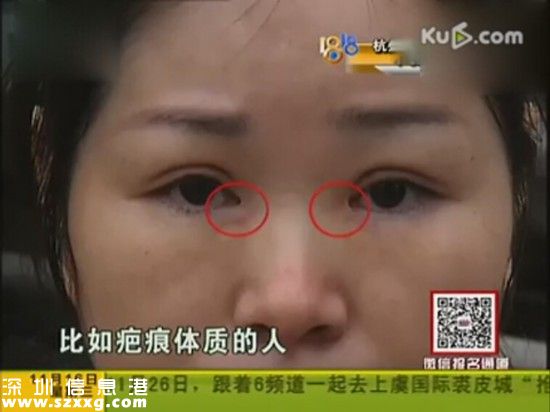 女子做完整形手術(shù)后上班被拒 老板娘：太嚇人了